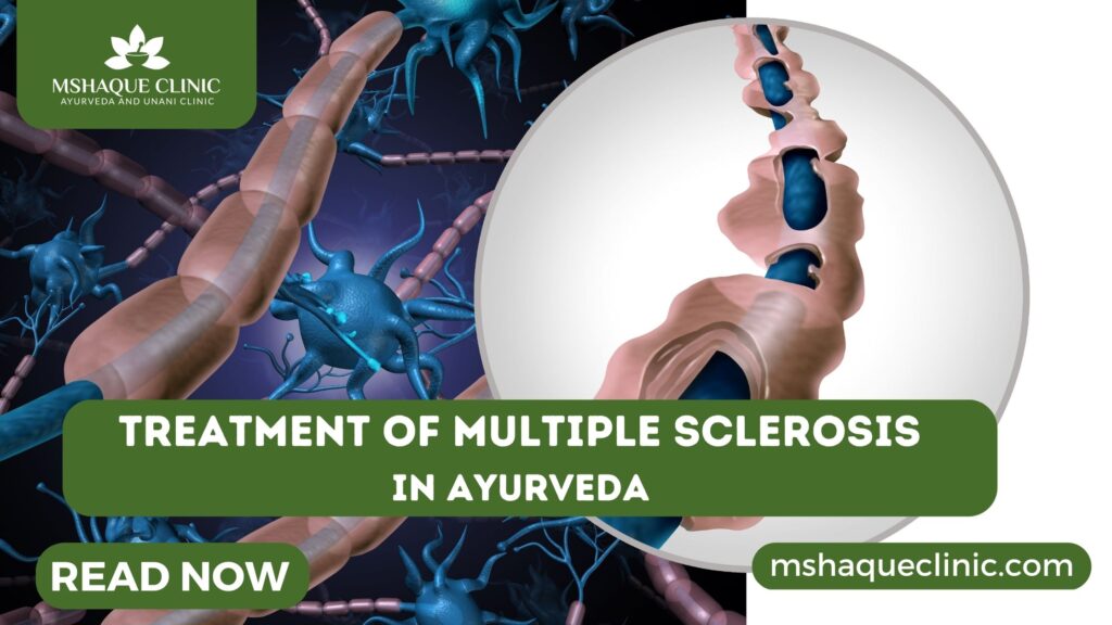 Treatment Of Multiple Sclerosis In Ayurveda
