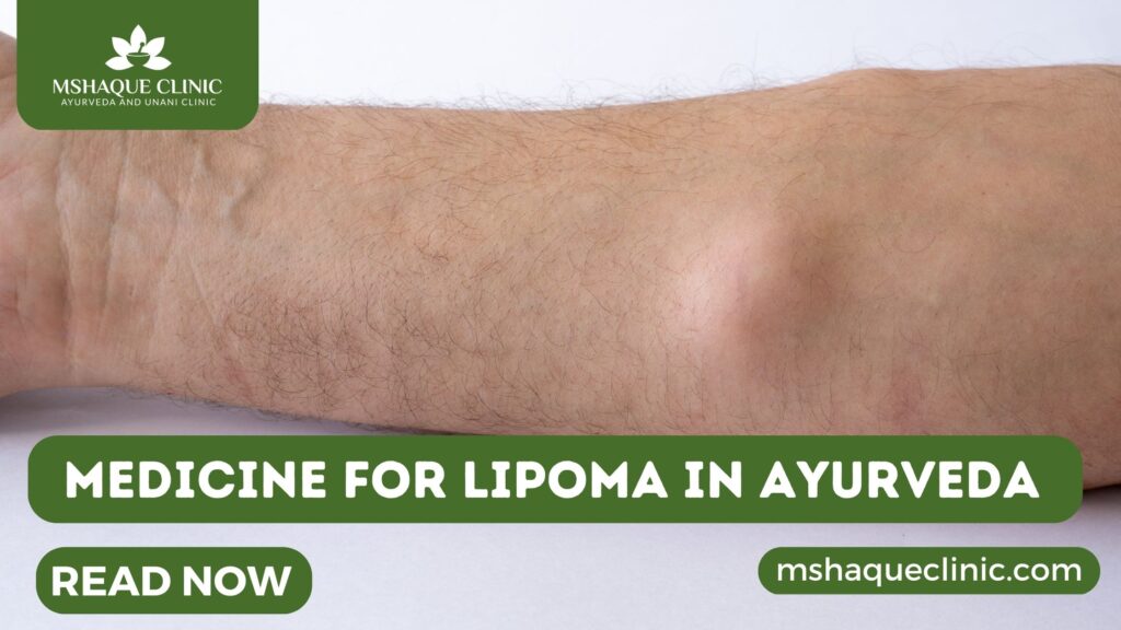 Medicine For Lipoma In Ayurveda