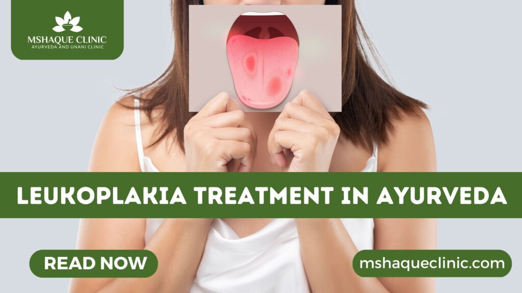 Leukoplakia Treatment In Ayurveda