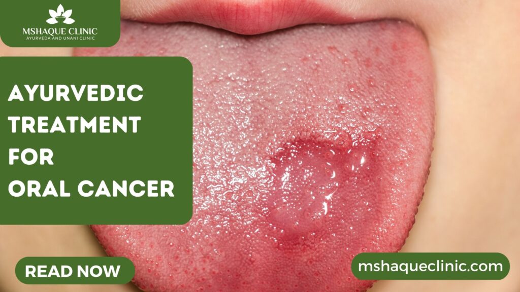 Ayurvedic Treatment For Oral Cancer