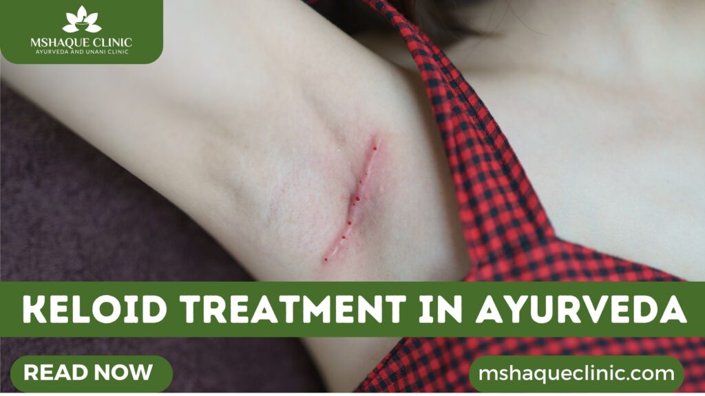 keloid treatment in Ayurveda
