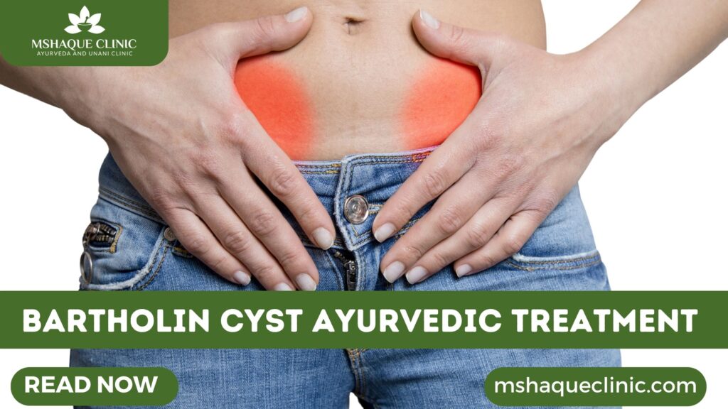 Bartholin Cyst Ayurvedic Treatment