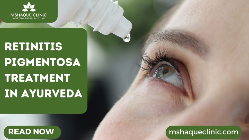 Retinitis Pigmentosa Treatment In Ayurveda