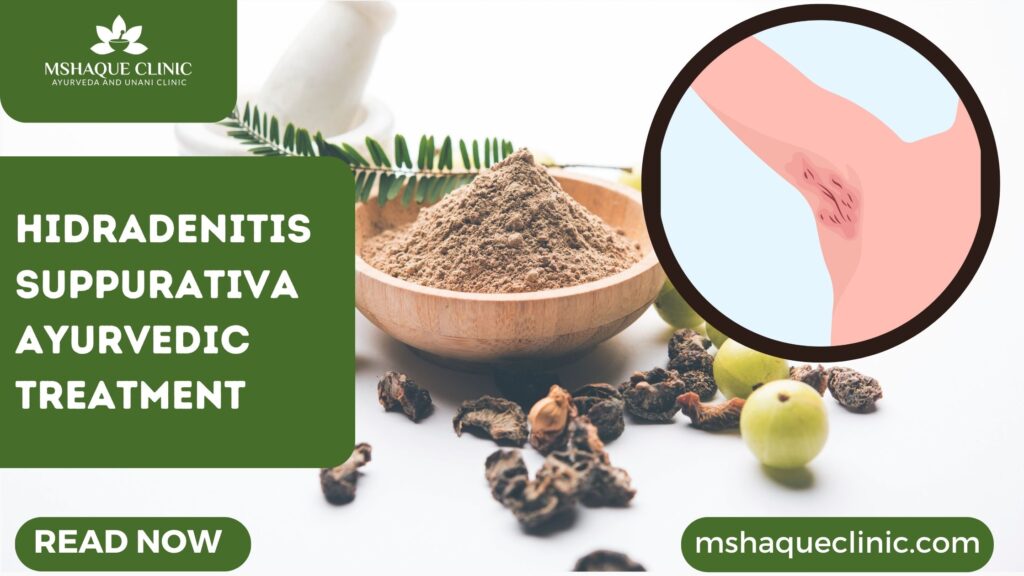 Hidradenitis Suppurativa Ayurvedic Treatment