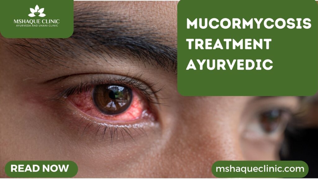 Mucormycosis Treatment Ayurvedic