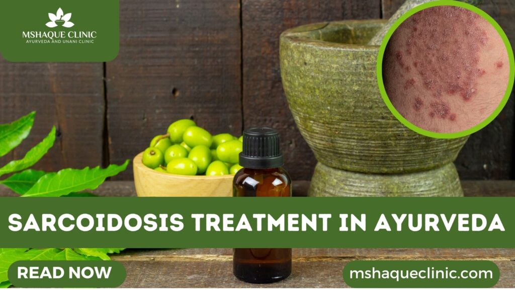 Sarcoidosis Treatment In Ayurveda
