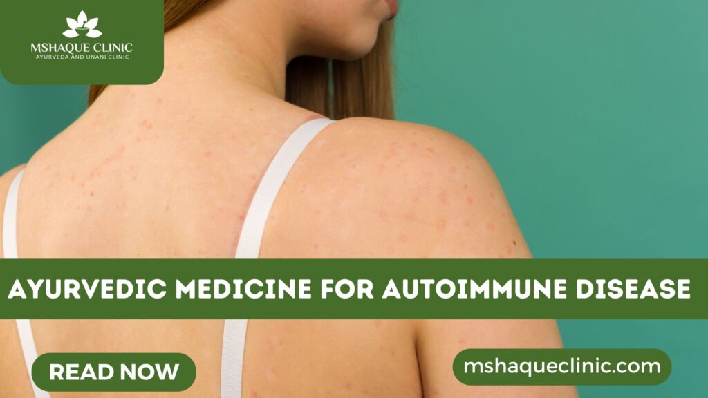 Ayurvedic Medicine For Autoimmune Disease