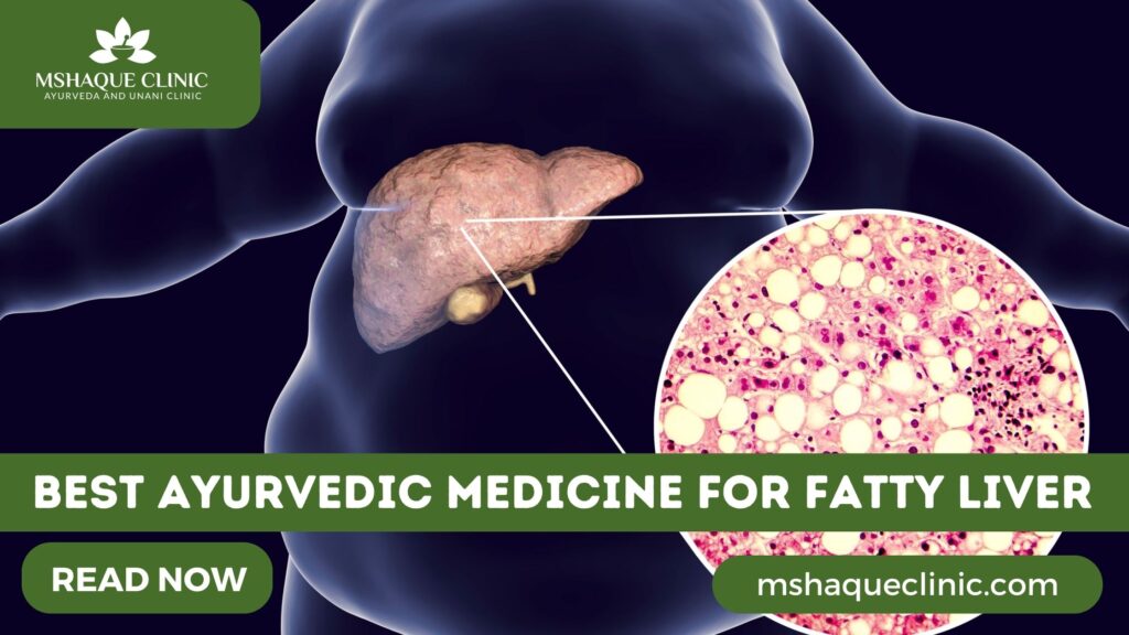 Best Ayurvedic Medicine For Fatty Liver
