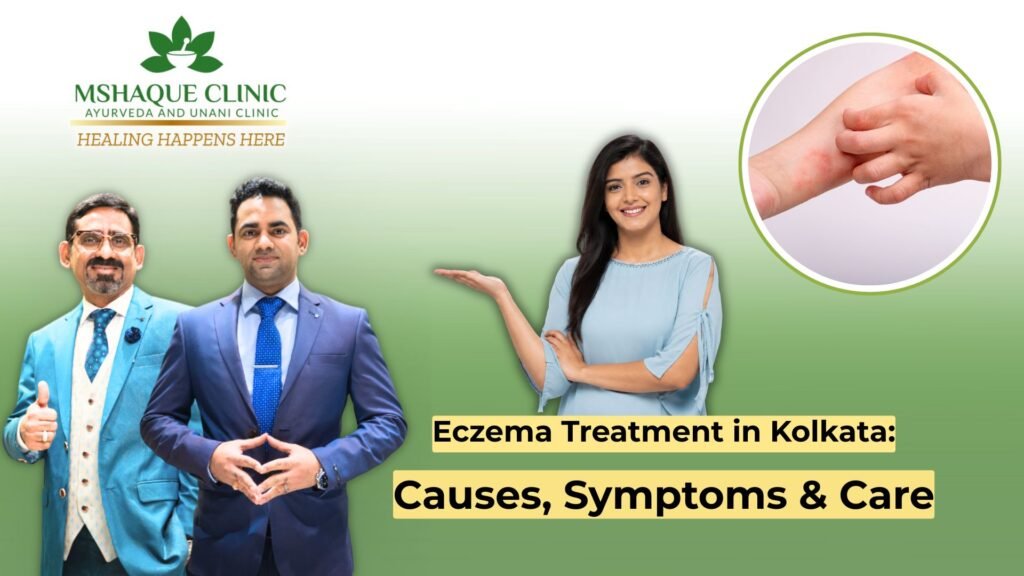 Eczema Treatment in Kolkata