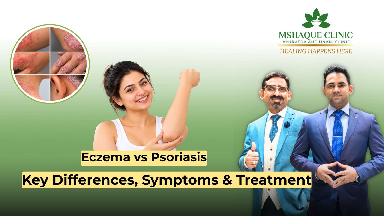 Eczema vs Psoriasis